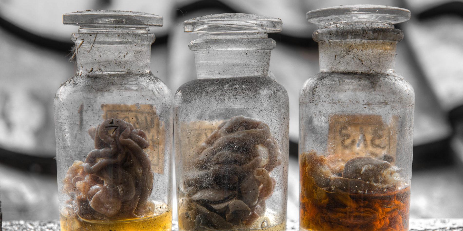 Au musée des pathologies, tout baigne... dans le formol