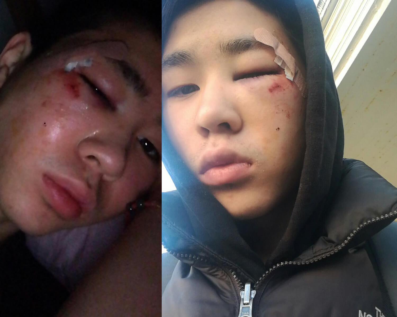 « J’ai 16 ans, je me suis fait tabasser par la police, alors que je n’avais rien fait »