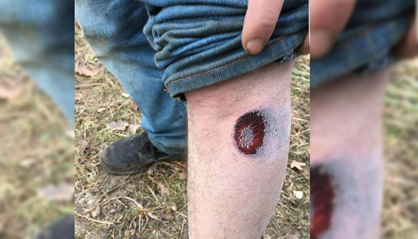 Quand les gendarmes tirent sur les teufeurs au flash ball