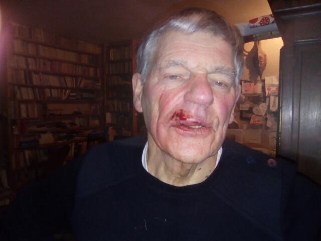 Gilbert, pasteur de 83 ans matraqué par les CRS : « La douleur a été extrême »