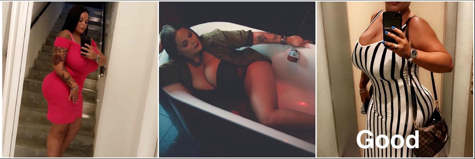 En 2015, la jeune femme part en Tunisie pour sa première liposuccion