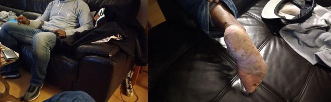 De nombreuses années après sa sortie, il garde des séquelles.