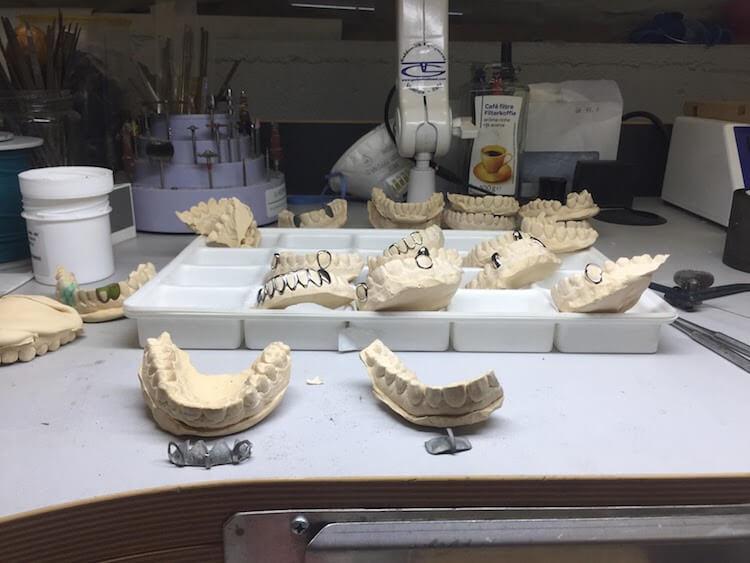 Il est armé jusqu'aux dents.