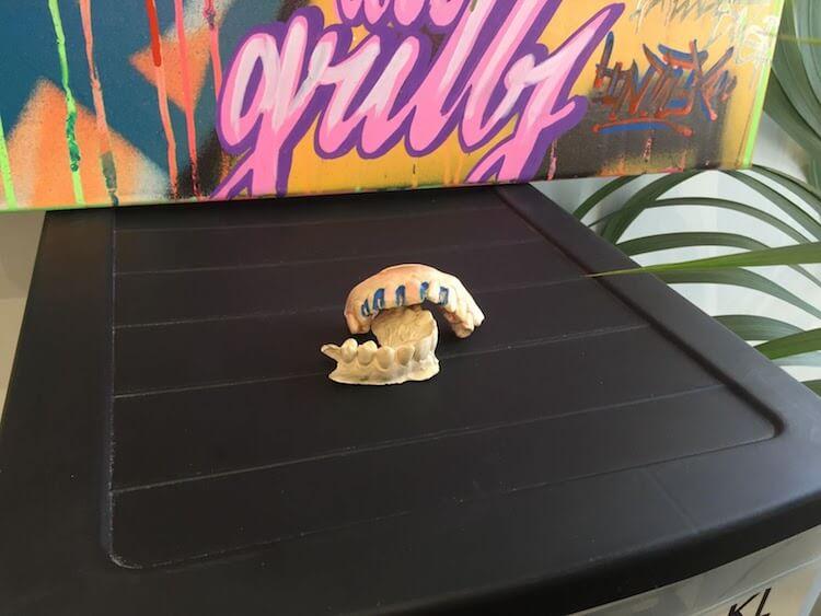 Le modelage qui a servi à réaliser un dentier vampire à Kaaris