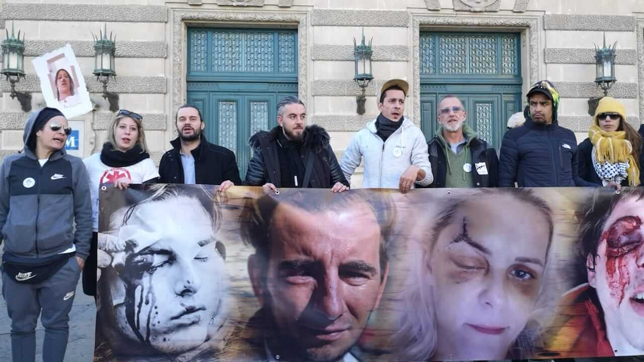 « Si je suis aux Restos du coeur, c’est parce que j’ai été mutilé par la police »