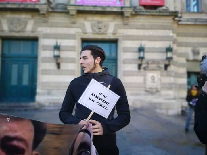 Dylan a 19 ans, il a été éborgné par une grenade de désencerclement.