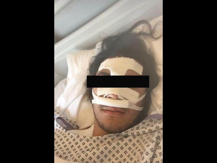 Sam s'est fait casser le nez après sa rencontre violente avec la Bac d'Argenteuil