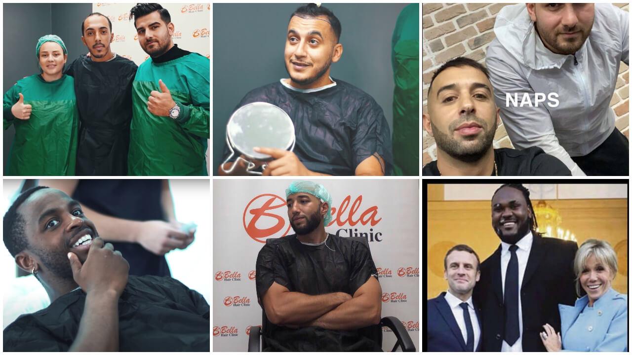 Rappeurs et stars du web font la promo des greffes de cheveux low-cost proposées en Turquie