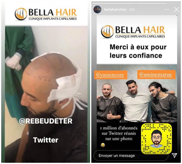 Des célèbres Twittos, comme Rebeu Deter (1,1 million de followers), Yassencore (250.000 followers) ou AmineMaTué (490.000 followers), font la pub des greffes turques low-cost.