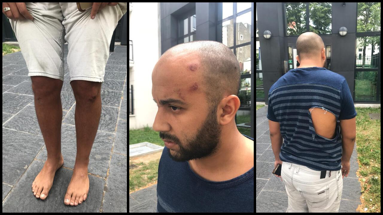 Insultes racistes et violences gratuites, la BAC d’Argenteuil à nouveau mise en cause