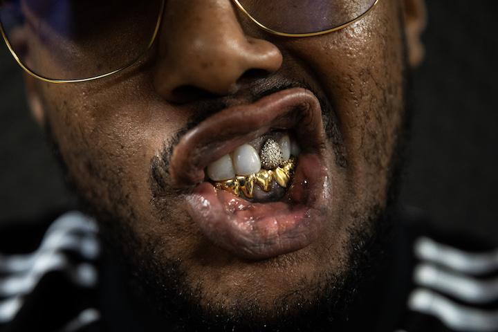 Babakam, grillz sur les dents