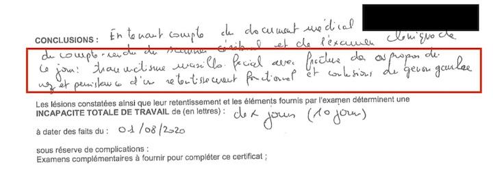 Le scanner cérébral détecte chez Matis une fracture des os propres du nez. Cela amène un médecin a lui donner dix jours d'ITT.