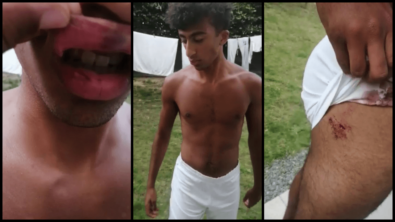 « J’ai été tabassé sans raison par deux videurs de boîte de nuit »