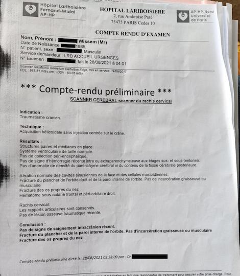 À l'hôpital Lariboisière, la nuit des faits, les médecins décèlent chez Wissem un traumatisme crânien, une fracture du plancher et de la paroi interne de l'orbite droit et une fracture des os propres du nez.