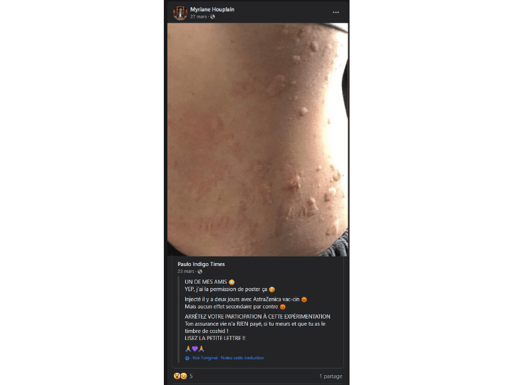 Le 27 mars, Myriane Houplain partage sur Facebook une photo non-sourcée d’un homme présentant soi-disant des plaques sur le corps après avoir été vacciné