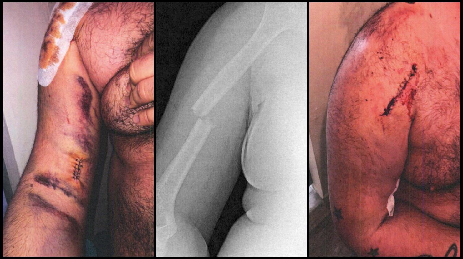 Pourquoi le vaccin fait flipper les Français