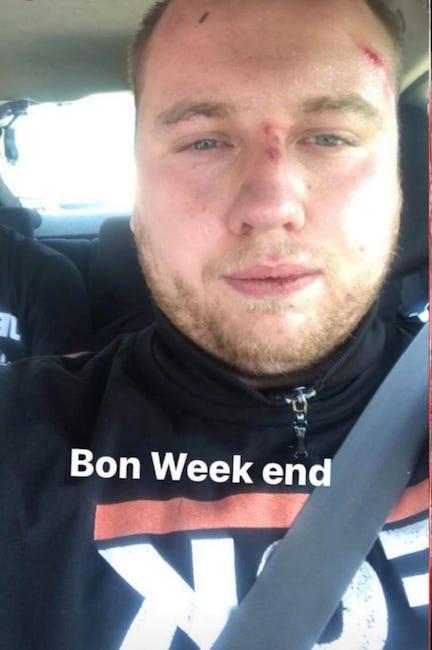 Le Zouaves Paris Hadrien M. vient d’attaquer StreetPress en justice pour injure publique et diffamation. Il conteste notamment avoir le goût de la bagarre. Ça ne l'a pas empêché de participer au fight et de s'en vanter sur les réseaux