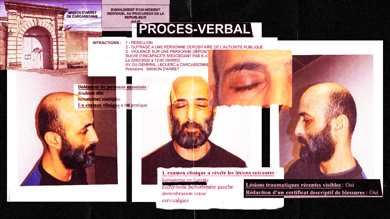 Mohamed, « passé à tabac » par des gardiens de prison