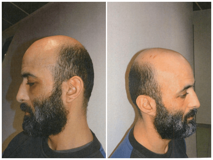 Les agents pénitentiaires indiquent avoir fait usage de « la force strictement nécessaire » et des « gestes réglementaires » pour maîtriser le détenu