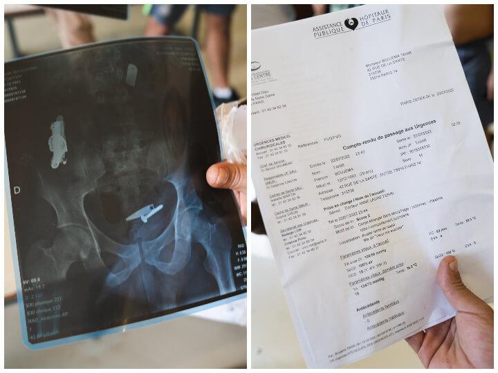 Fin juin, Tahir a avalé des coupe-ongles – puis une lame de rasoir quelques semaines plus tard – pour se suicider. Les objets sont toujours dans son ventre.