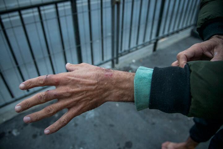 Des membre de Tendre la main ont pris l’habitude de faire escale à la pharmacie avant de se rendre sur le campement, pour acheter des bandages et du désinfectant