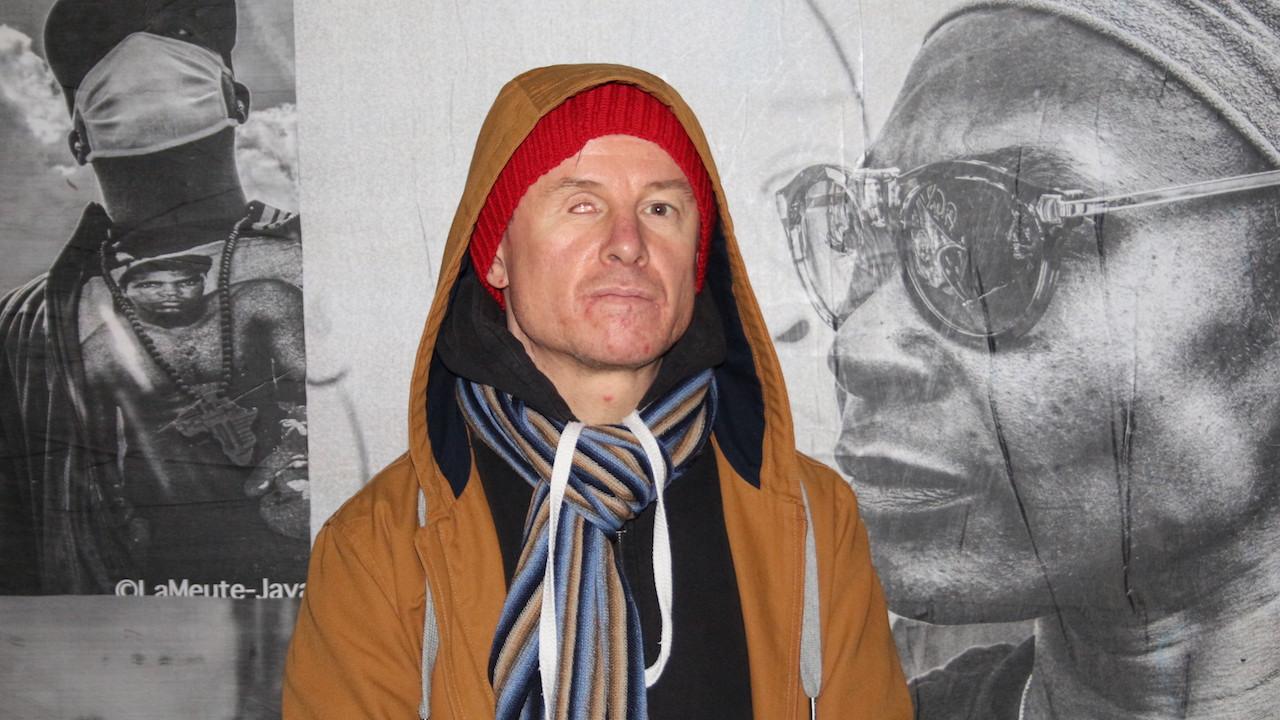 Après la perte de son œil, Laurent Theron est en arrêt maladie pendant seulement trois petites semaines