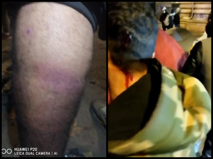 Le 5 décembre, après une assemblée générale sauvage, les policiers interviennent et frappent à coups de matraques plusieurs habitants du camp de la Chapelle.