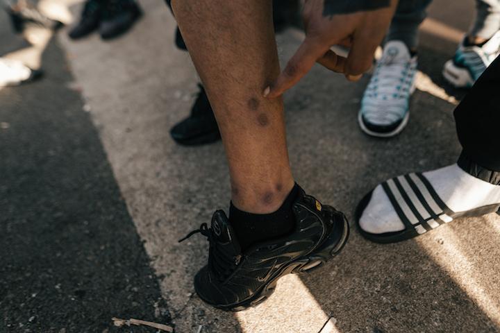 Ayoub a quitté la Libye en bateau en passant par l'Italie, et se serait fait tirer sur les jambes. Enfermé depuis mardi au Mesnil-Amelot, il ne devrait pas tarder à y être renvoyé.