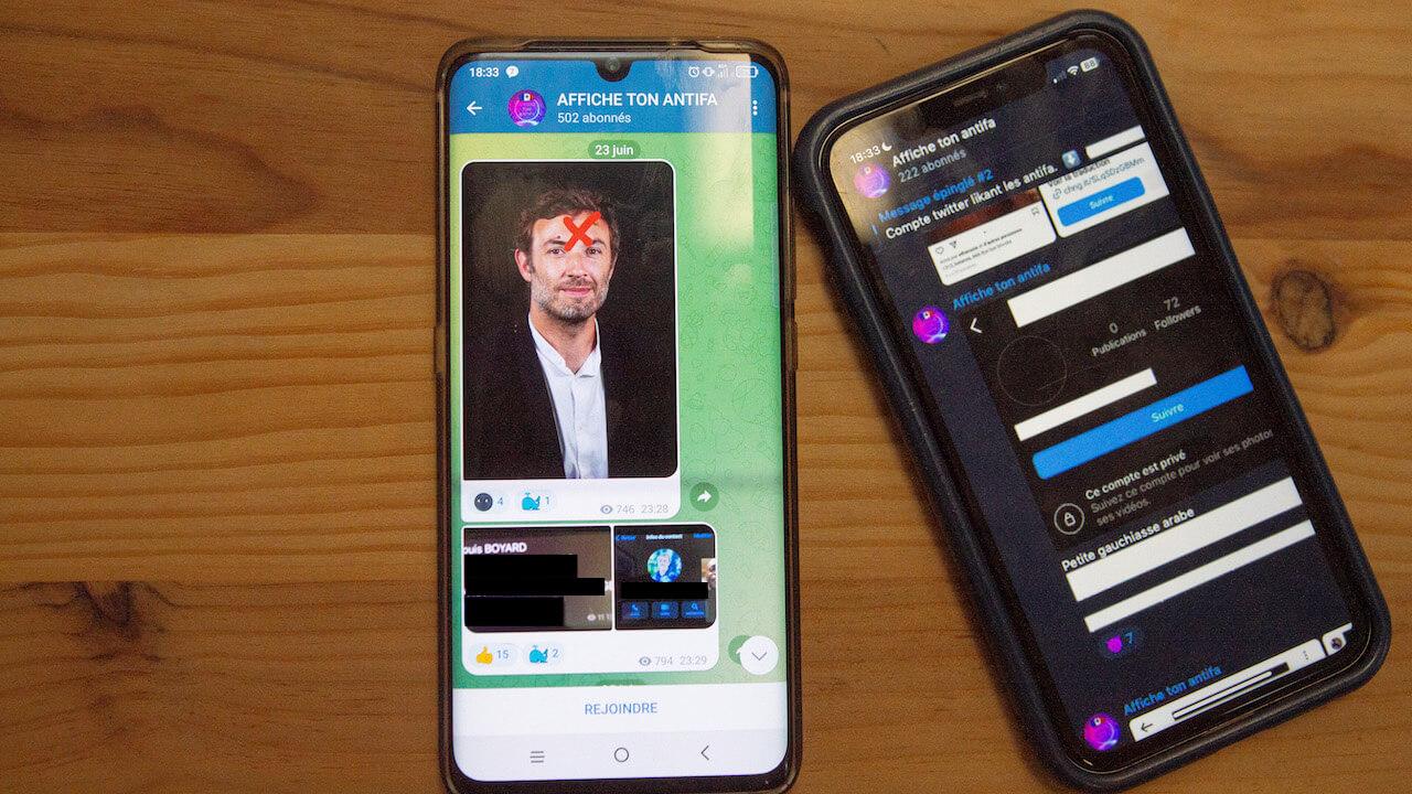Pourquoi le vaccin fait flipper les Français