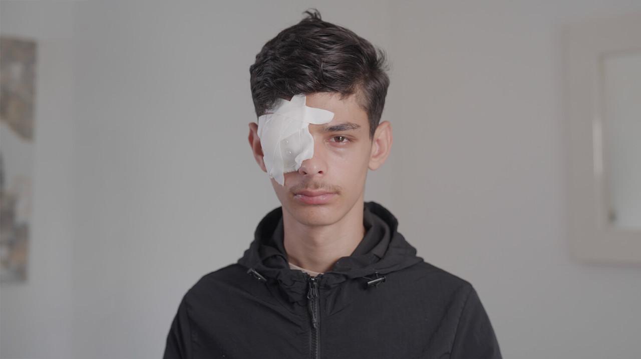 Jalil, 15 ans, éborgné par la police pendant les révoltes à Chilly-Mazarin