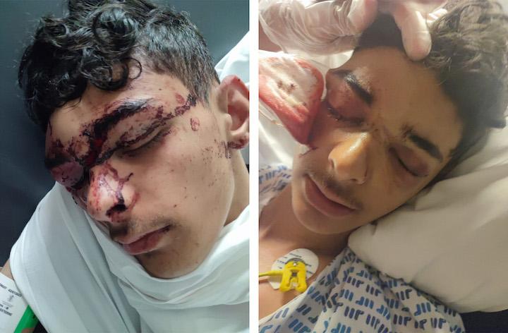 Jalil s'est évanoui et se souvient vomir du sang à plusieurs reprises. Il est amené à l'hôpital par les pompiers pour « traumatisme crânien et maxillo-facial » .