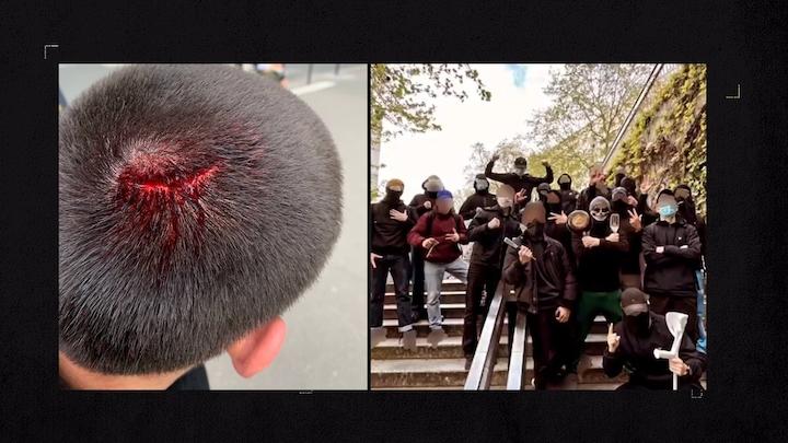 En avril 2023, la division Martel monte une équipe d’une vingtaine de « fachos » pour aller tabasser quelques jeunes d’origine maghrébine devant l’établissement Victor Hugo. Un des jeunes du groupe est blessé au crâne.