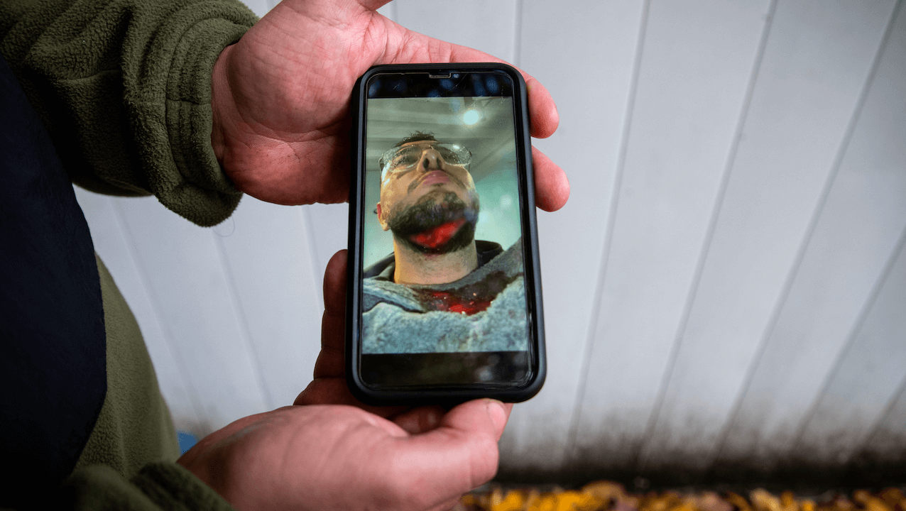 Tentative d’égorgement islamophobe dans le Val-de-Marne