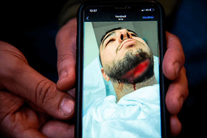 La médecin a accordé au jeune homme 15 jours d’Incapacité totale de travail