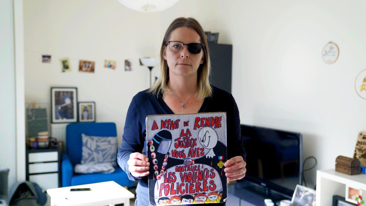 L’État refuse d’indemniser la Gilet jaune éborgnée Vanessa Langard