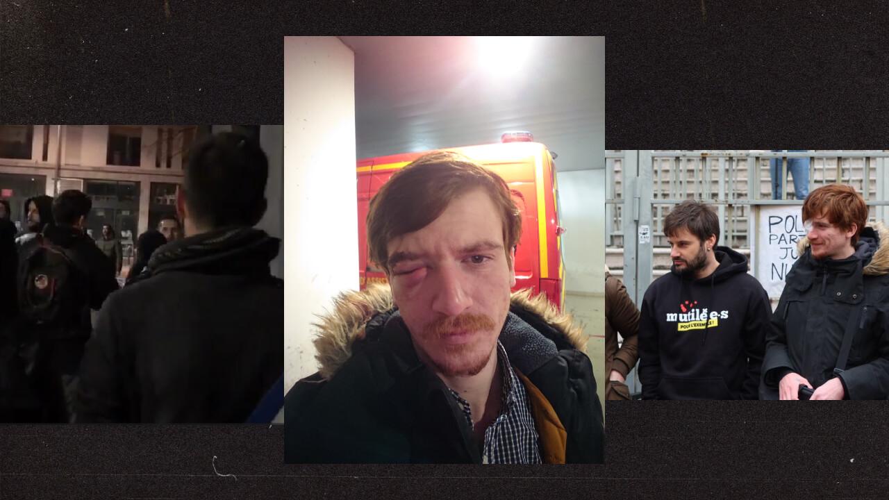 À Marseille, un policier éborgne un manifestant, bouscule un élu et profère des insultes homophobes