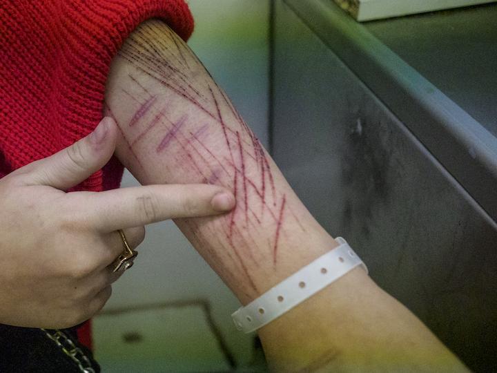 Mustapha est abîmé. Sur ses bras, des scarifications se mélangent à ses problèmes de peau