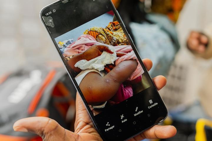 Aïcha montre des photos de sa fille de deux ans couverte de boutons semblables à la gale et à des piqûres de punaises de lit