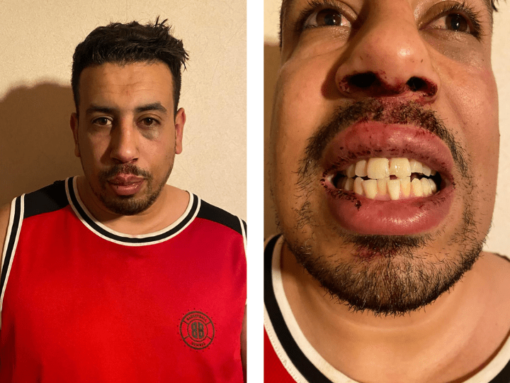 Sami Jabel a eu huit jours d’incapacité totale de travail