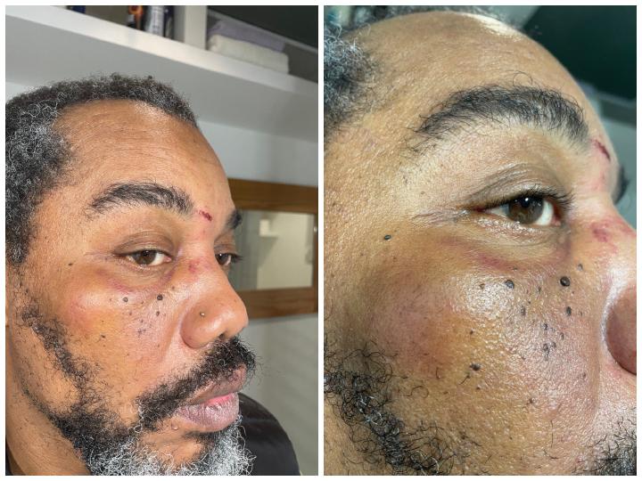 Rod aurait pris de nouveaux coups dans la voiture de police