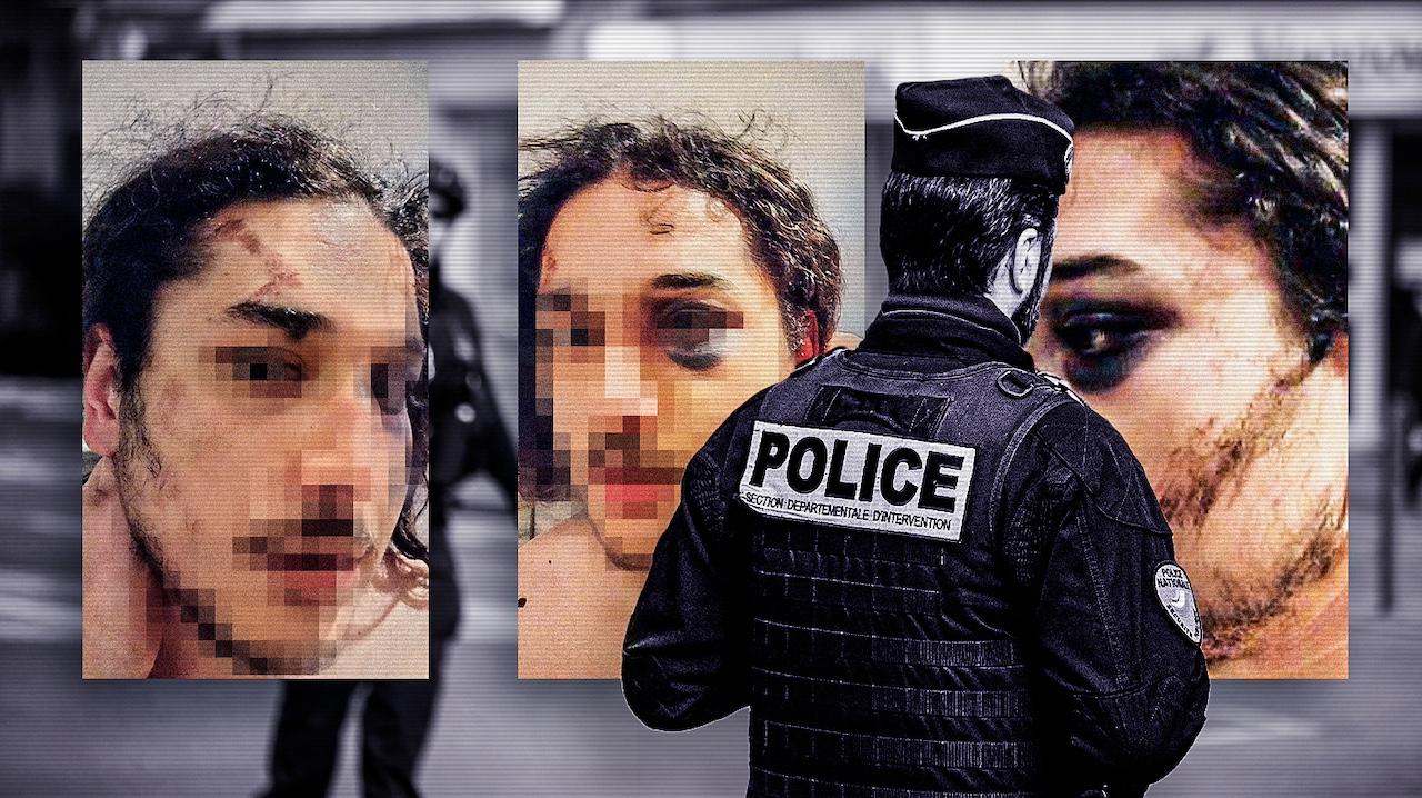 Adil, victime de coups de taser, tabassages et racisme policier