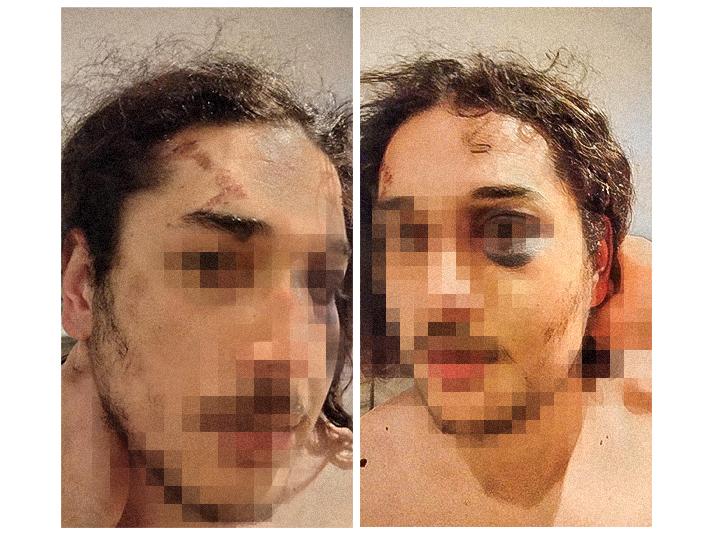 Adil, étudiant algérien en droit, a été contrôlé puis interpellé par la police, à 23 heures dans une rue de Drancy. Il dénonce des violences physiques et sexuelles dans la rue, pendant son transport, et au commissariat. Il a déposé plainte