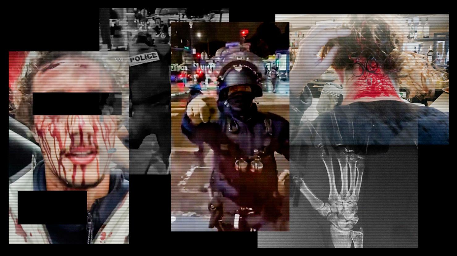 Le 10 septembre, une journée de violences policières passée au crible