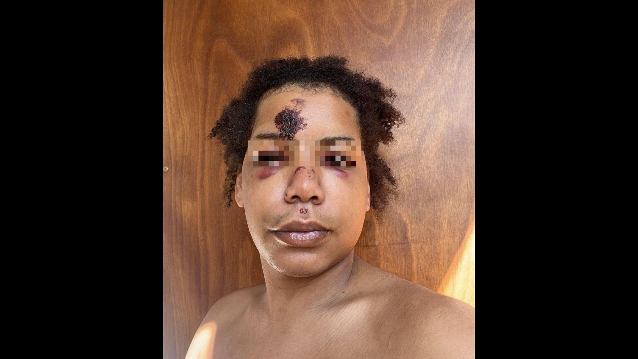 Agressée et blessée après une attaque transphobe, une femme transgenre finit devant la justice