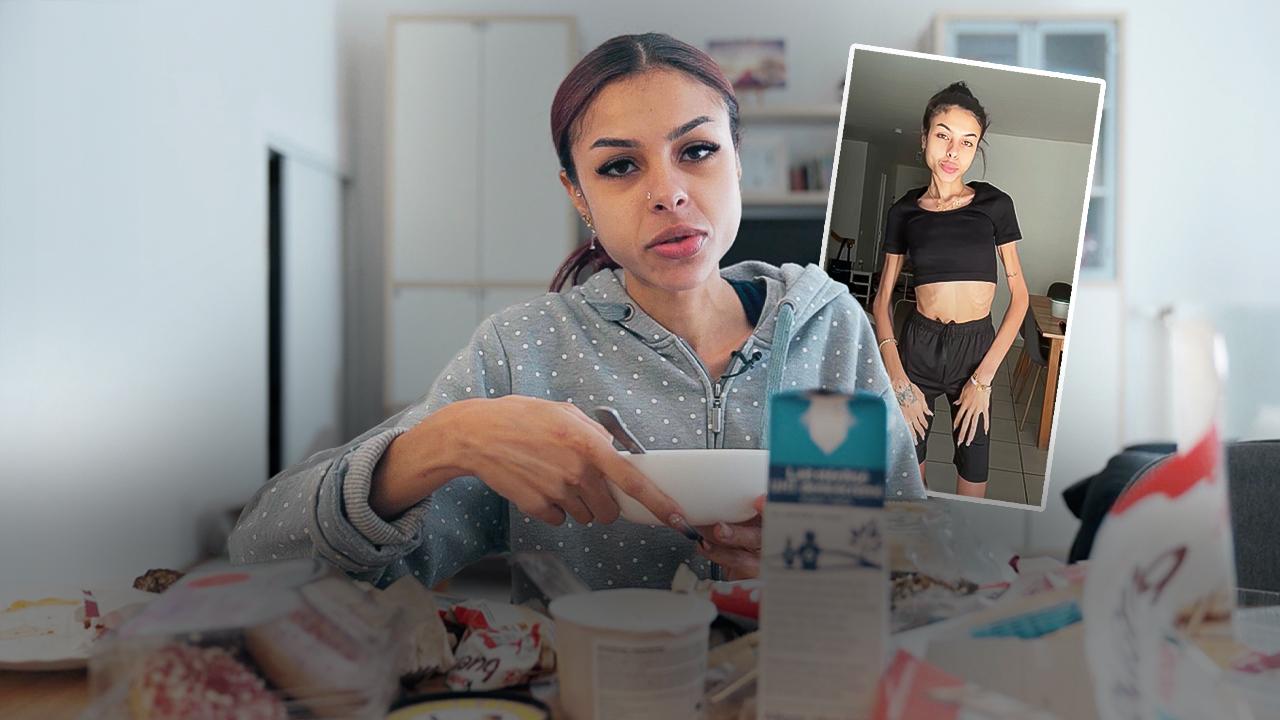 « Vomir c'est détruire son corps » : Assyia, anorexique et boulimique