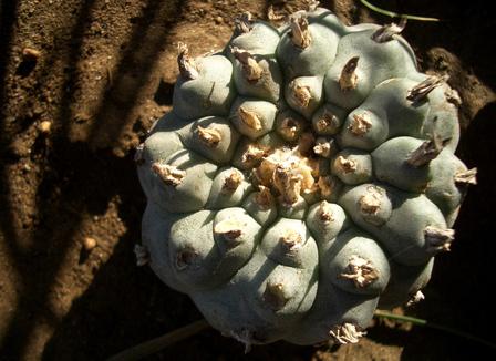 Pourquoi le vaccin fait flipper les Français